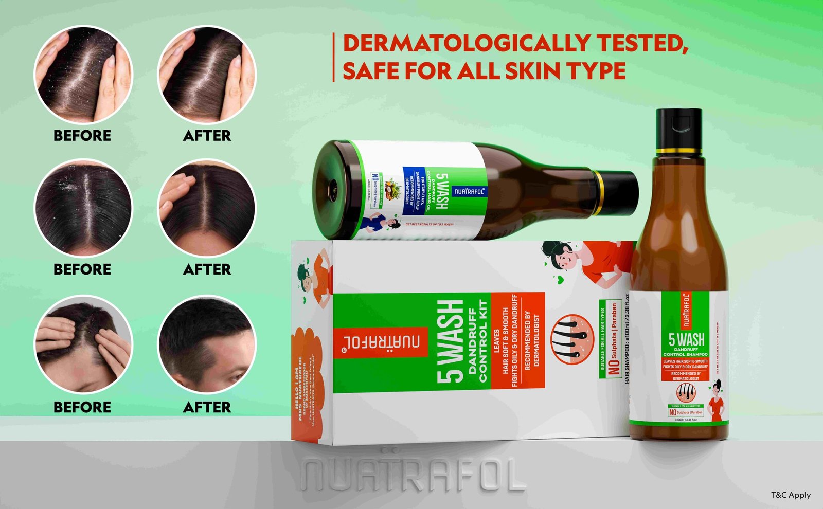 N Dandruff Control Kit Web Post-05 (1)