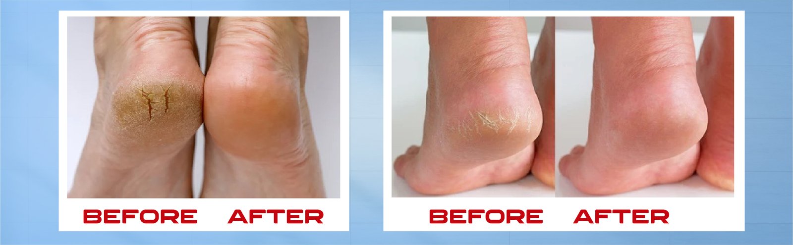 N Foot Cream Tube Web Post-03 (1)