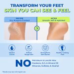 20% Urea Foot Roll-On with 5% Lactic Acid & 2% Glycolic Acid - Image 8